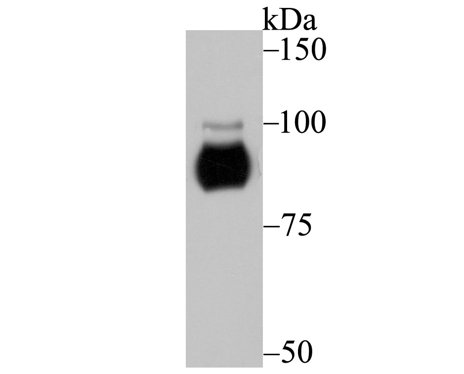 Anti-Protein Kinase D2/PRKD2 Antibody (5O381)