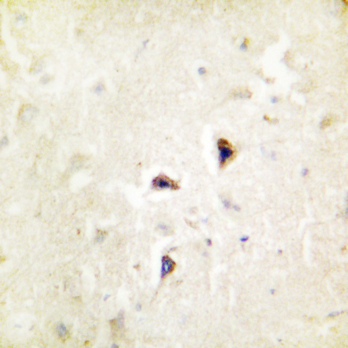 Anti-Phospho-Rabphilin 3A (Ser237) Polyclonal Antibody 2