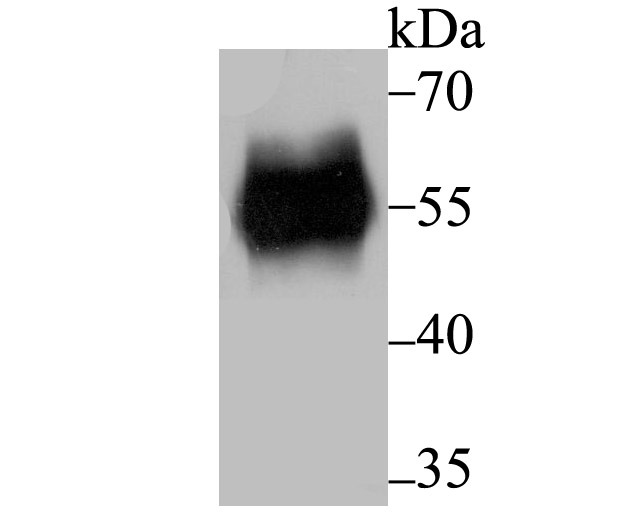 Anti-RBPJK Antibody (5Y131)