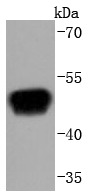Anti-RAGE Antibody (3H335)
