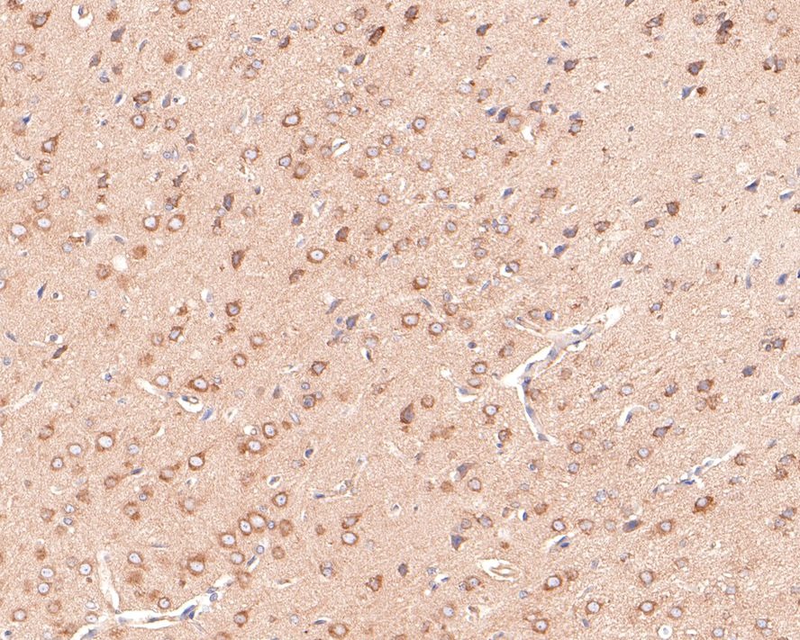 Anti-PIEZO1 Antibody (9P32)