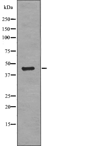 Anti-Phospho-RCC1 (Ser11) Polyclonal Antibody