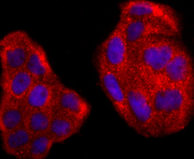 Anti-RAC1/2/3 Antibody (1M237)