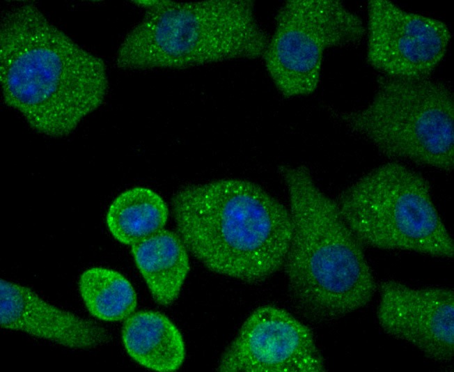 Anti-Protein Kinase D2/PRKD2 Antibody (5O381)