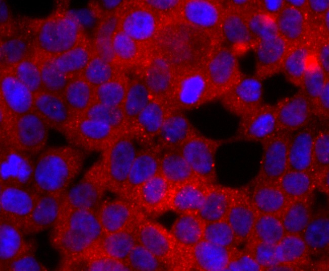 Anti-RAC1/2/3 Antibody (1M237)