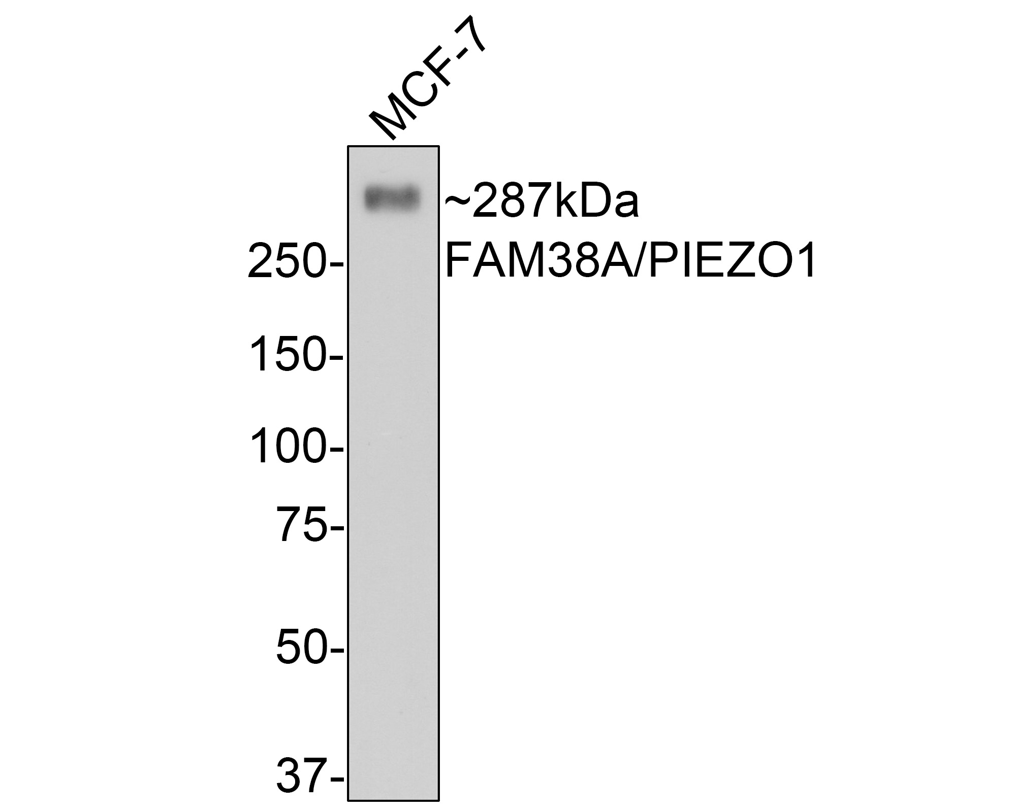 Anti-PIEZO1 Antibody (9P32)