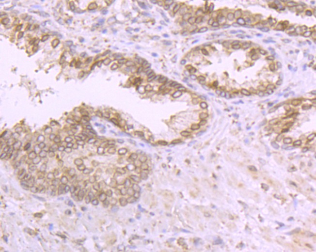 Anti-RanGAP1 Antibody (8X592)