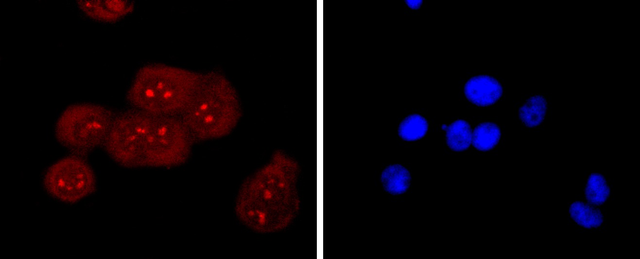 Anti-RAGE Antibody (3H335)