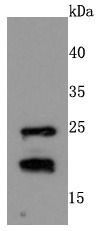 Anti-RAC1/2/3 Antibody (1M237)