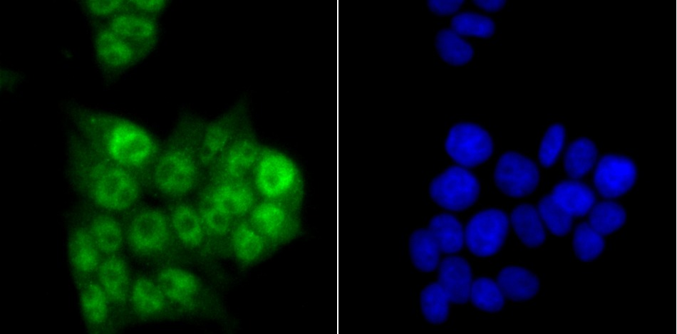 Anti-PRPF8 Antibody (4V102)