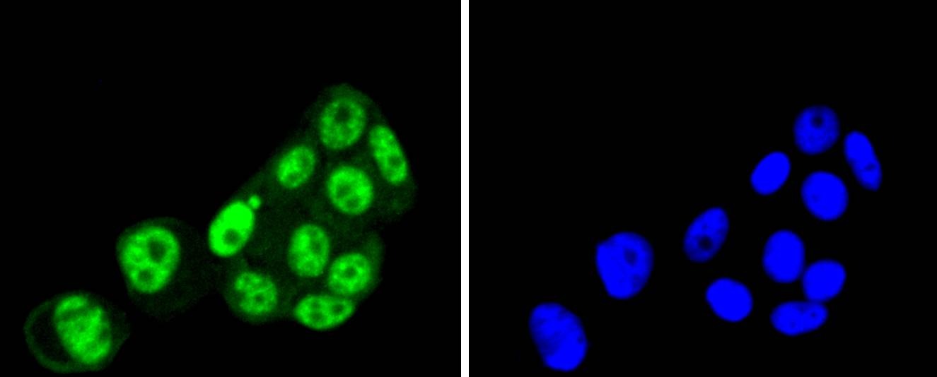 Anti-PRP19 Antibody (7U313)