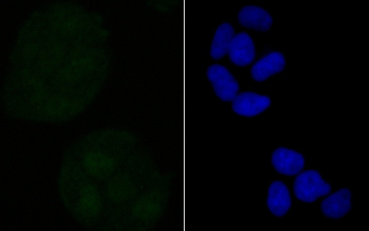 Anti-Retinoid X Receptor alpha Antibody (8D993)