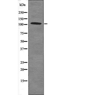 Anti-Phospho-RB1 (Thr252) Polyclonal Antibody