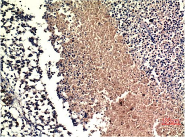 Anti-PTEN Antibody (7F933)