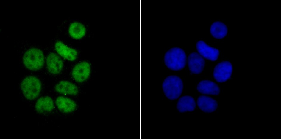 Anti-RBBP4 Antibody (7R532)