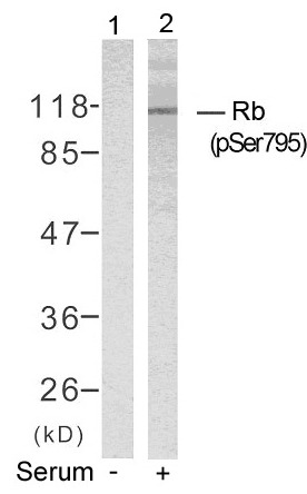 Anti-Phospho-RB1 (Ser795) Polyclonal Antibody