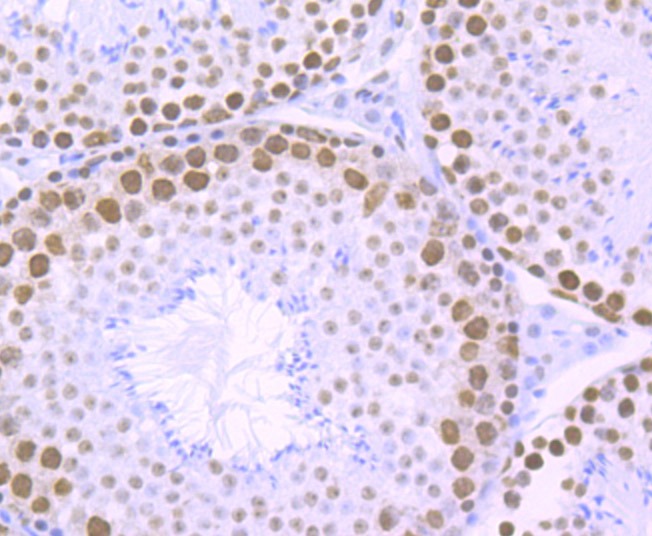 Anti-RBBP4 Antibody (7R532)