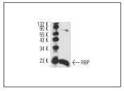 Anti-RBP4 Antibody (1C724)