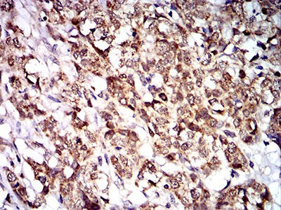 Anti-PTPN14 Antibody (8D656)