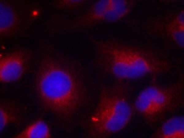 Anti-Phospho-PTEN (Ser380) Polyclonal Antibody