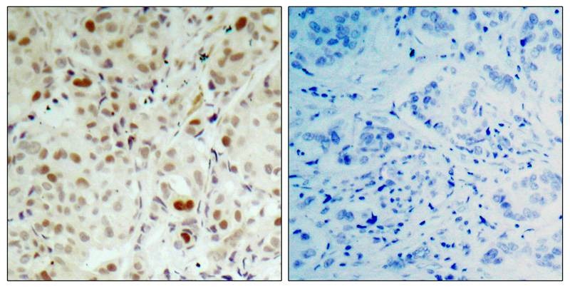 Anti-Phospho-RB1 (Ser807) Polyclonal Antibody
