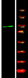 Anti-Phospho-RBBP8 (Ser664) Polyclonal Antibody