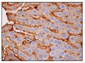 Anti-RBP4 Antibody (1C724)