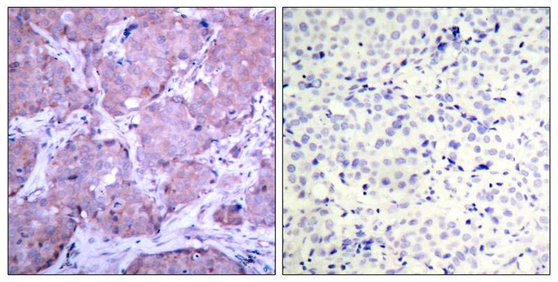 Anti-Phospho-PTEN (Ser380) Polyclonal Antibody