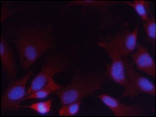Anti-Phospho-PTEN (Ser380, Thr382, 383) Polyclonal Antibody