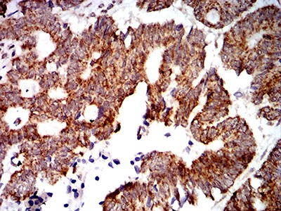 Anti-PTPN14 Antibody (8D656)