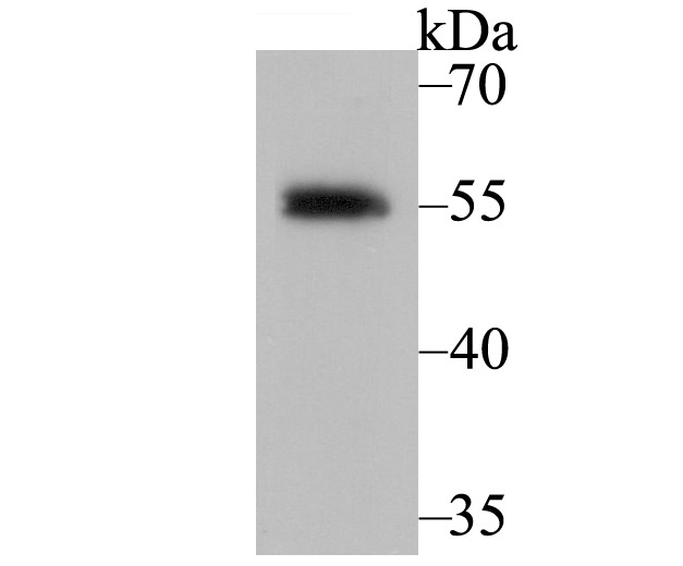 Anti-Retinoid X Receptor alpha Antibody (8D993)