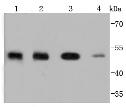 Anti-PTP1B Antibody (4L780)
