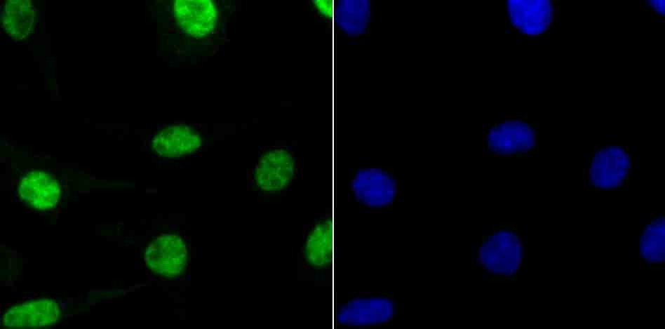 Anti-RBBP4 Antibody (7R532)