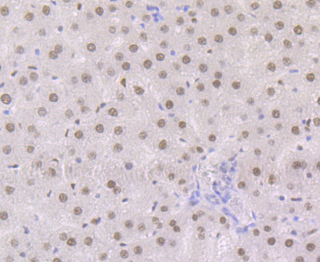 Anti-Retinoid X Receptor alpha Antibody (8D993)