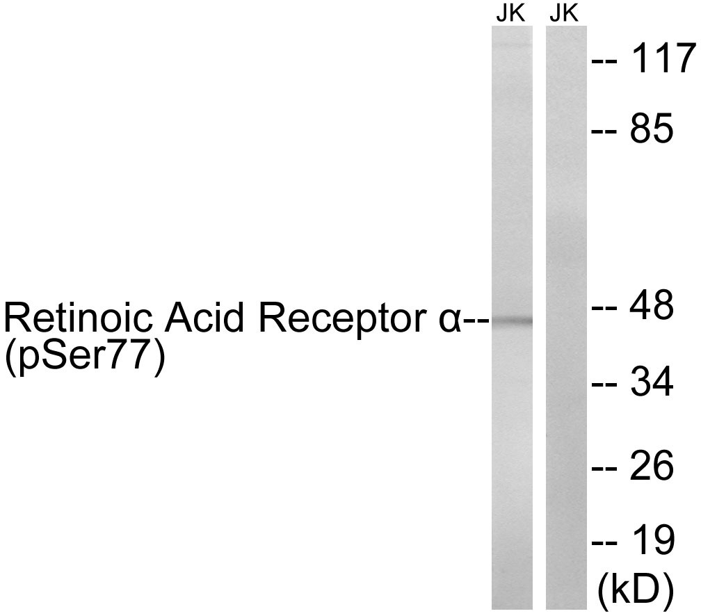 Anti-Phospho-RARA (Ser77) Polyclonal Antibody