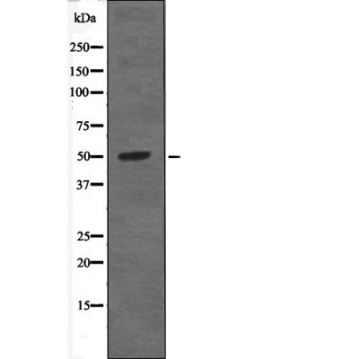 Anti-Phospho-PTP1B (Tyr66) Polyclonal Antibody
