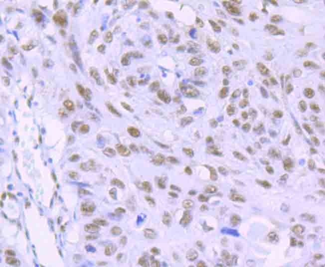 Anti-RBBP4 Antibody (7R532)