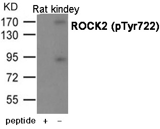 Anti-Phospho-ROCK2 (Tyr722) Polyclonal Antibody