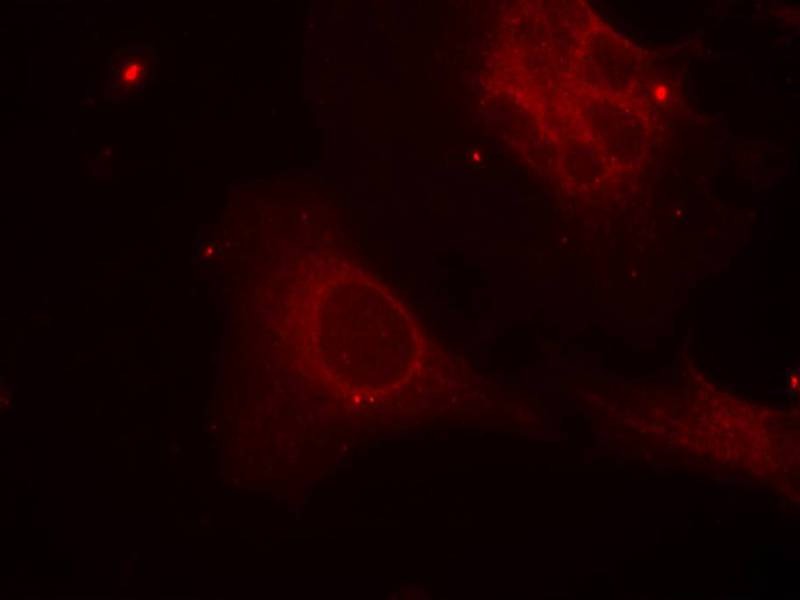Anti-Phospho-Shc (Tyr349) Polyclonal Antibody