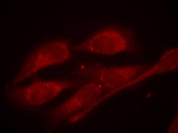 Anti-Phospho-Shc (Tyr427) Polyclonal Antibody