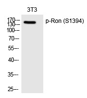 Anti-Phospho-RON/CD136 (Ser1394) Polyclonal Antibody