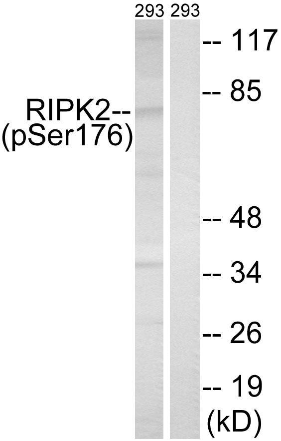 Anti-Phospho-RIPK2 (Ser176) Polyclonal Antibody