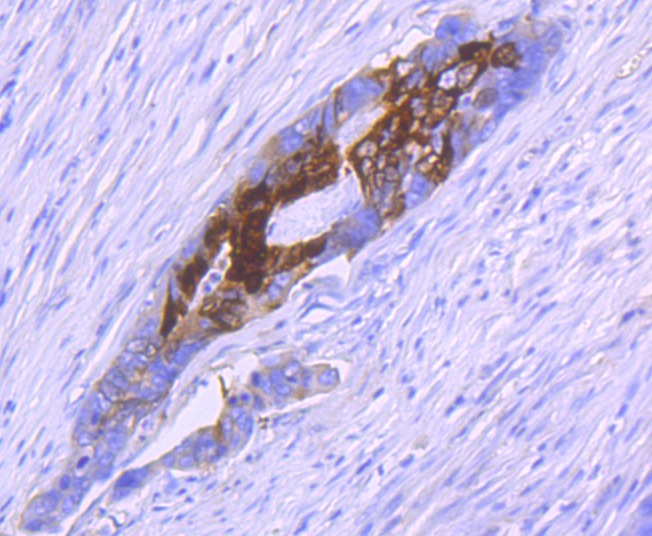 Anti-S100A10 Antibody (8Q369)