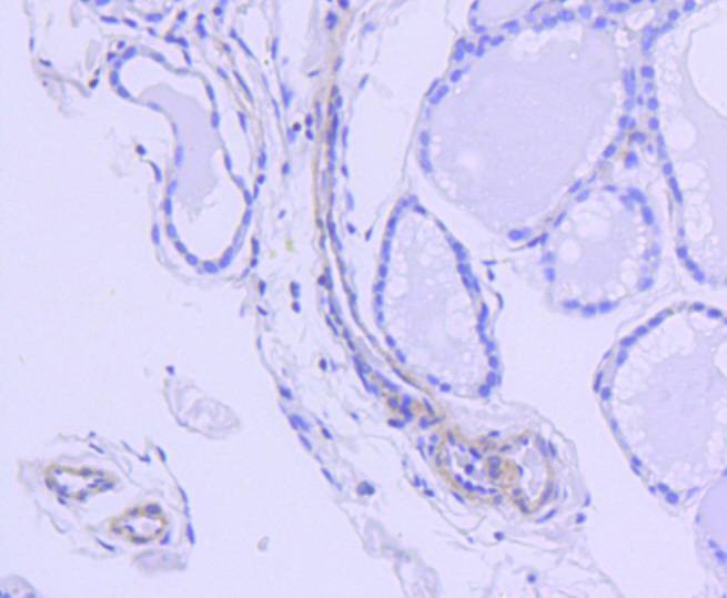 Anti-ROCK1 Antibody (4X563)