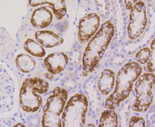 Anti-RPS3 Antibody (4S186)
