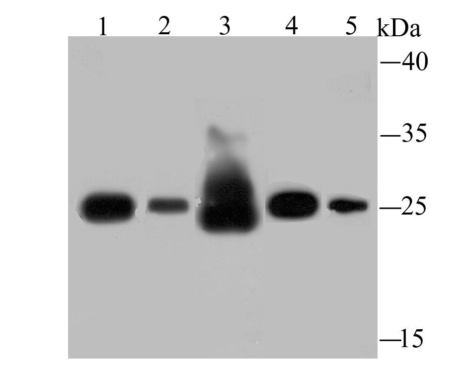 Anti-SDHB Antibody (3I144)