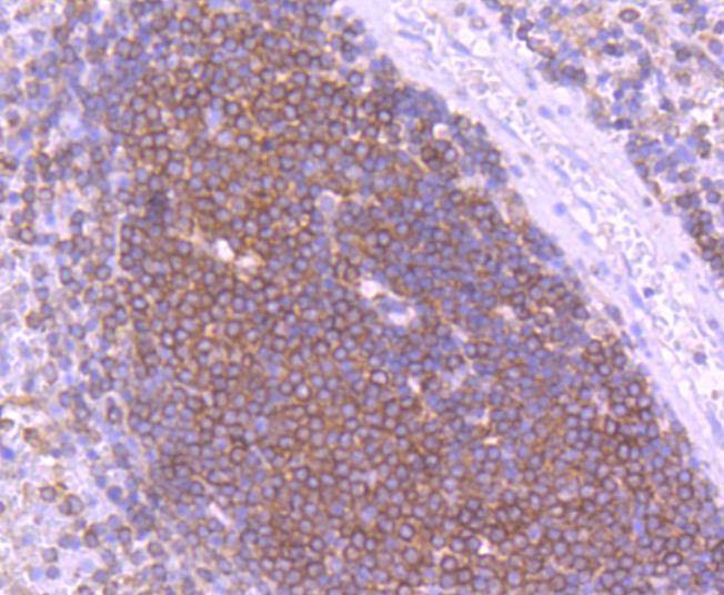 Anti-INPP5D Antibody (9H177)