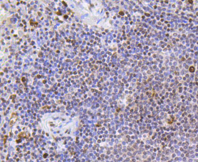 Anti-SR-BI/SCARB1 Antibody (1A957)