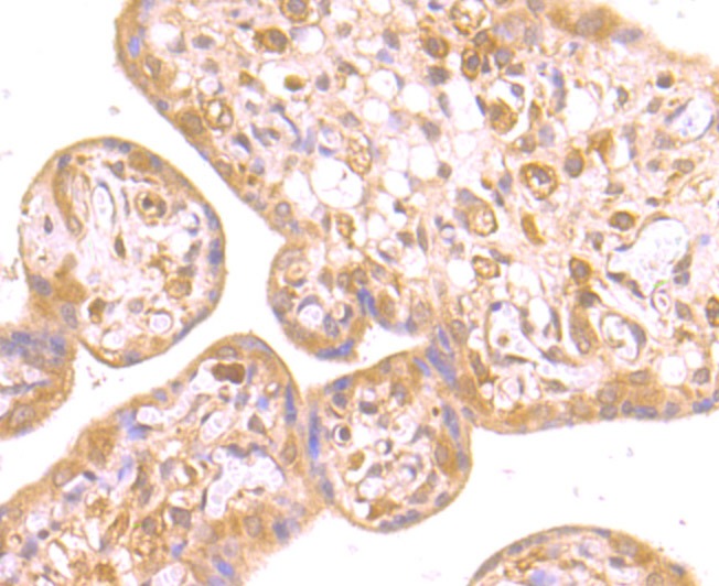 Anti-RING2 Antibody (5I450)