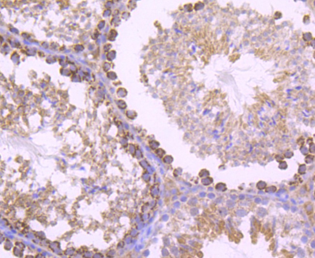 Anti-SDHA Antibody (3R603)